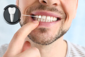 The image shows a close-up of a smiling person's lower face, highlighting their teeth. A finger is pointing to one of the teeth, and there is an inset graphic of a dental implant next to the area bein