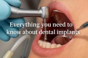 A close up of a dentist inserting a titanium post into a patient's jaw, with other tools in the background. The text overlayed on the image reads "Everything you need to know about dental implants".