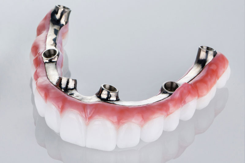 zirconia upper bridge model light back ground